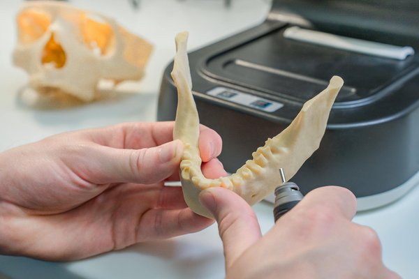 Implants Dentaires Reseau
